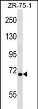 TEC Antibody (N-term)