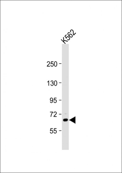 TEC Antibody (N-term)