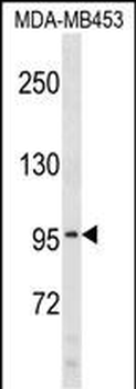 COL6A2 Antibody (C-term)