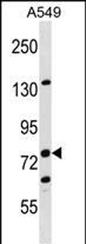 LIMA1 Antibody (N-term)