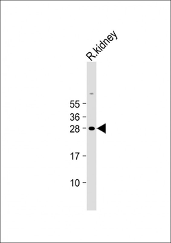 Erythropoietin Antibody (N-term)