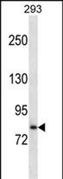 SLC39A6 Antibody (Center)