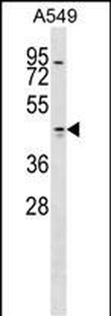 TMOD1 Antibody (Center)
