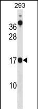 CHCHD10 Antibody (N-term)