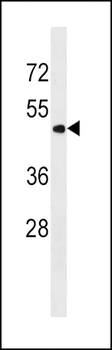 PNPLA3 Antibody (N-term)