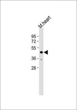 PNPLA3 Antibody (N-term)