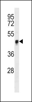 YAP Antibody (Center S127)
