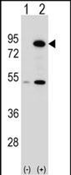 THOC1 Antibody (C-term)