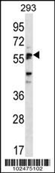 SIGLEC6 Antibody (C-term)