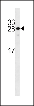 KLF9 Antibody (N-term)