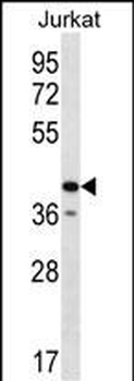 GORASP2 Antibody (Center)