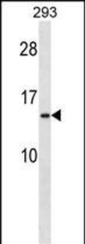 RPS20 Antibody (N-term)