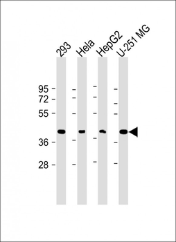 GIPC1 Antibody (N-term)