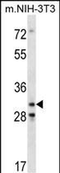 Mouse Cdk4 Antibody (C-term)