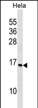 RPS14 Antibody (C-term)