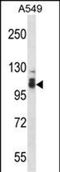 SMEK2 Antibody (C-term)