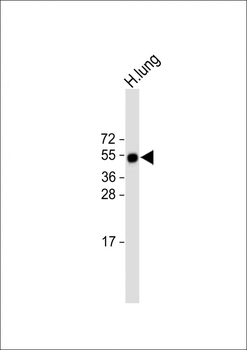 RAMP3 Antibody (C-term)