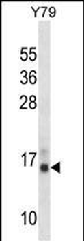 PFN2 Antibody (C-term)