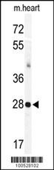 KChIP3 Antibody (N-term M1)