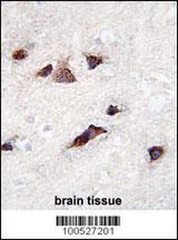 KChIP3 Antibody (N-term M1)