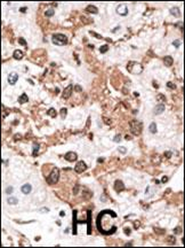 KChIP3 Antibody (N-term M1)