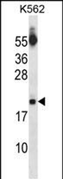 SAP18 Antibody (Center)