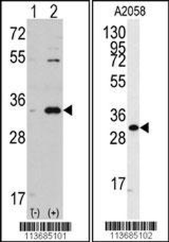 CDC2 Antibody (C-term)