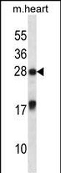 MXI1 Antibody (Center)