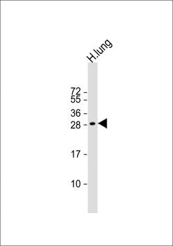 MXI1 Antibody (Center)