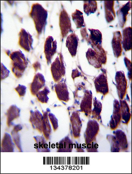 POLG Antibody (C-term)