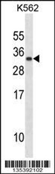 PRL Antibody (C-term)