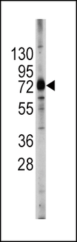 ABCG2 (BCRP) Antibody (Center)