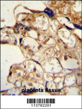 ABCG2 (BCRP) Antibody (Center)