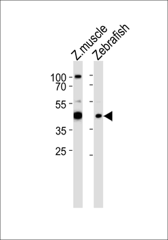 RBM22 Antibody (Center)