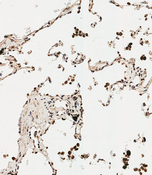 SMAD9 Antibody (Center)