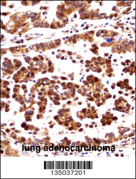 ORC3L Antibody (N-term)