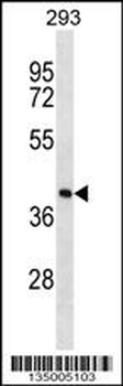 FDPS Antibody (N-term)