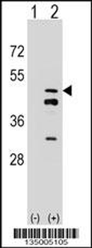FDPS Antibody (N-term)
