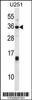 STC1 Antibody (C-term)