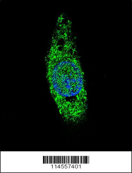 LIN28B Antibody (Center)