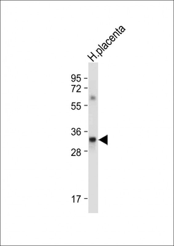 LIN28B Antibody (Center)