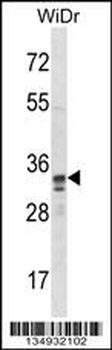 SPI1 Antibody (C-term)