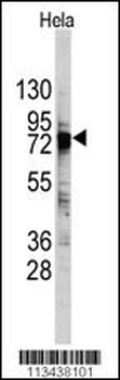 DDX3 Antibody (C-term)