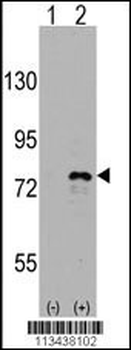 DDX3 Antibody (C-term)