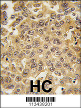 DDX3 Antibody (C-term)
