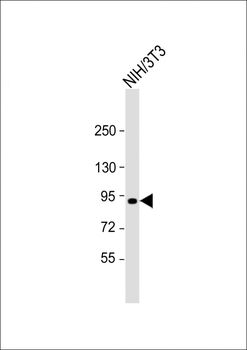 Mouse Eef2k Antibody (N-term)