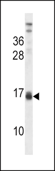 LALBA Antibody (Center)