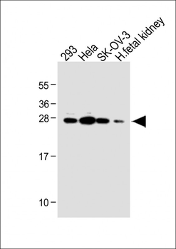 TGIF2 Antibody (C-term)