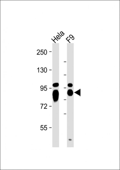 ALPL Antibody (Center)