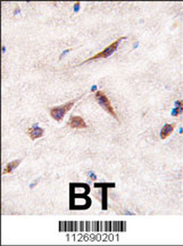 ERAS Antibody (N-term)